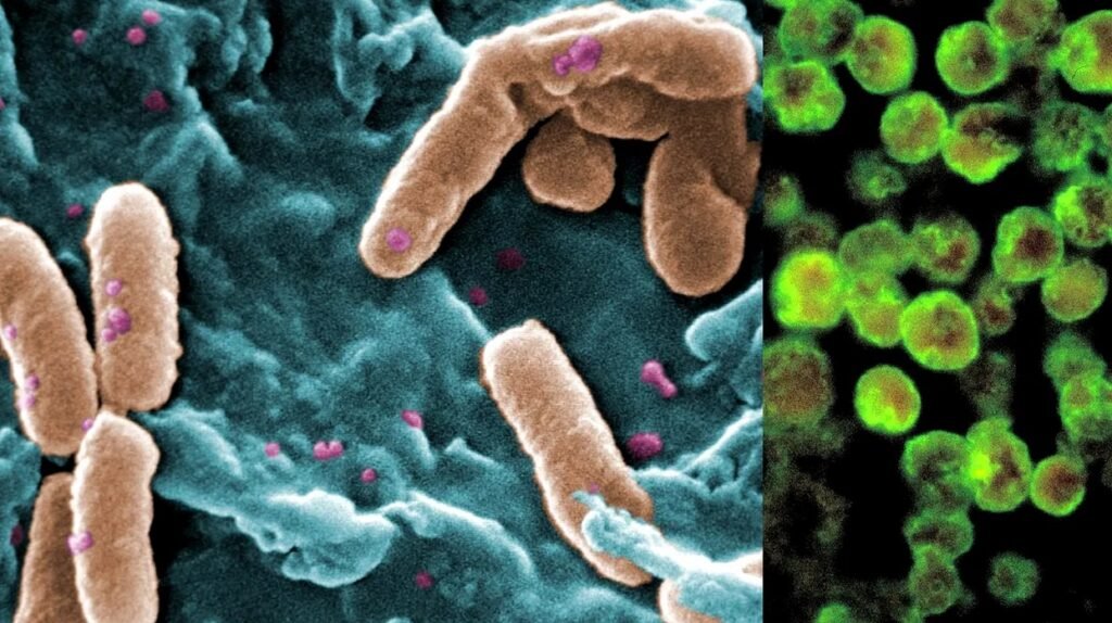 Holera face prăpăd într-o țară africană. Cel puțin 158 de persoane au murit