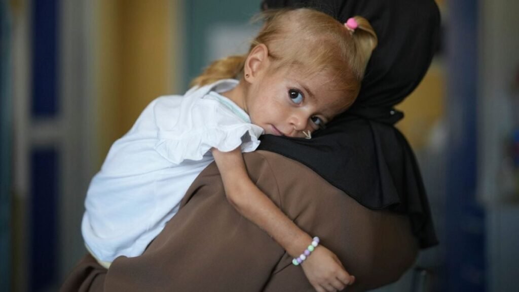 In imagine Shamm Qudeih,o fetiță de 2 ani, în bluză albă si cu bratara la mana, în bratele mamei ei în timpul unui interviu acordat Associated Press la Spitalul de Copii Santobono Pausilipon din Napoli, sudul Italiei, marți, 2 septembrie 2025, unde Shamm este tratată după ce a fost evacuată din Gaza.