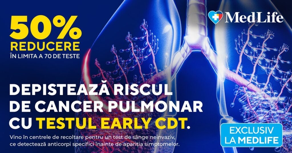 Află dacă ai risc de cancer pulmonar. MedLife oferă reducere de 50% la Testul Early CDT Află dacă ai risc de cancer pulmonar. MedLife oferă reducere de 50% la Testul Early CDT