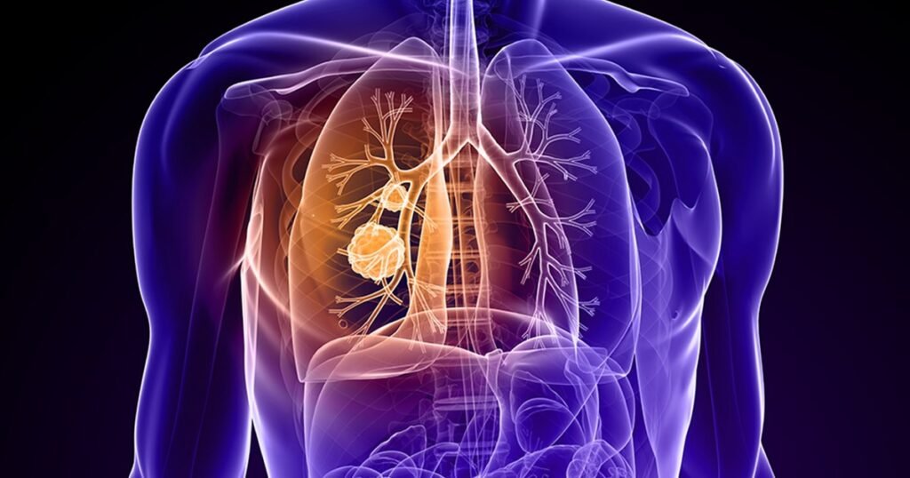 Cum poate fi prevenit cancerul: strategii susținute de cercetare și dovezi științifice