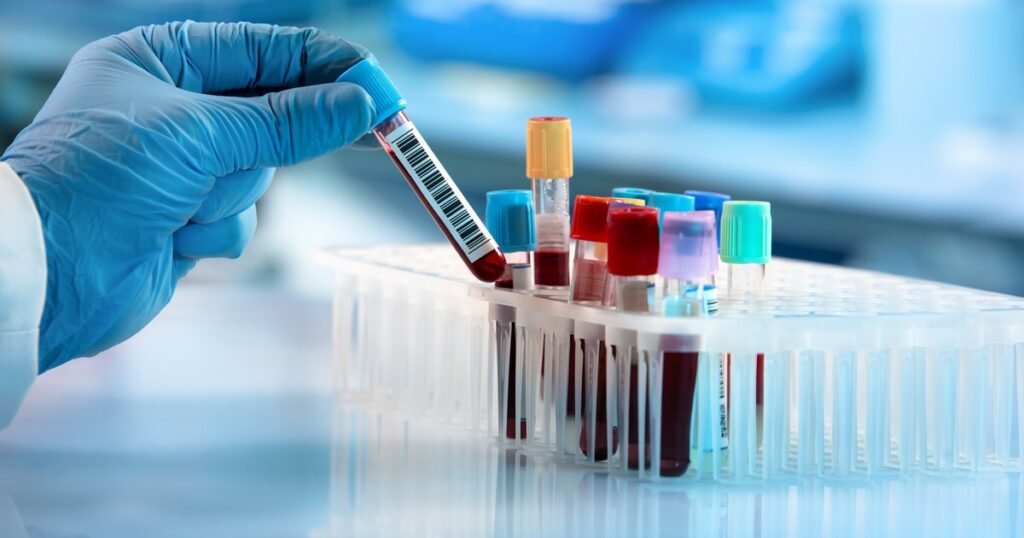 Testul de sânge care ar putea detecta cancerul cerebral. Ce au descoperit oamenii de știință
