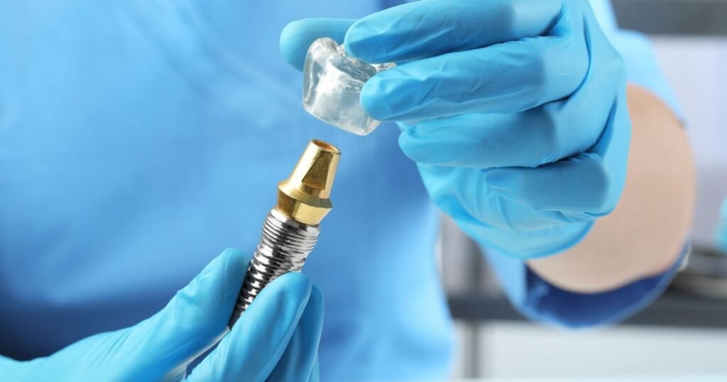Ce include prețul unui implant dentar complet: De la consultatie la control final
