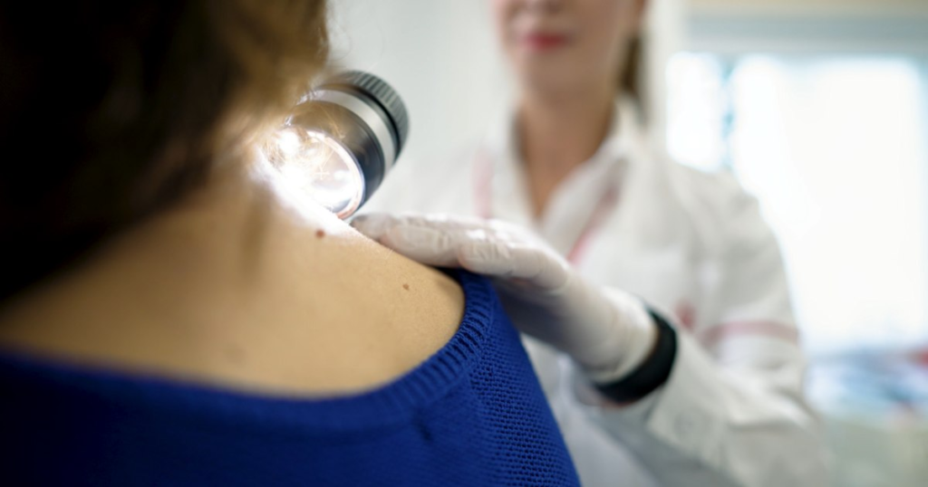 În București a fost deschis un centru dedicat diagnosticării și tratării melanomului